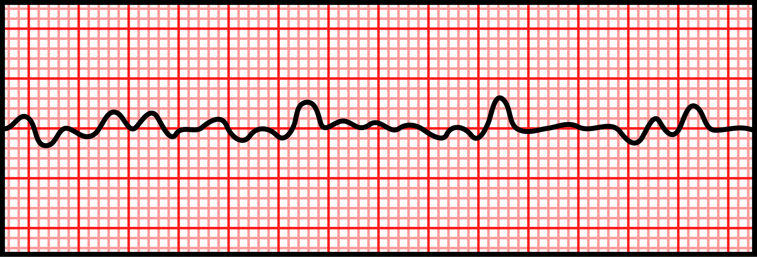 A 3-second rhythm strip illustrating ventricular fibrillation (V-fib), characterized by rapid, erratic electrical activity and the absence of organized QRS complexes.