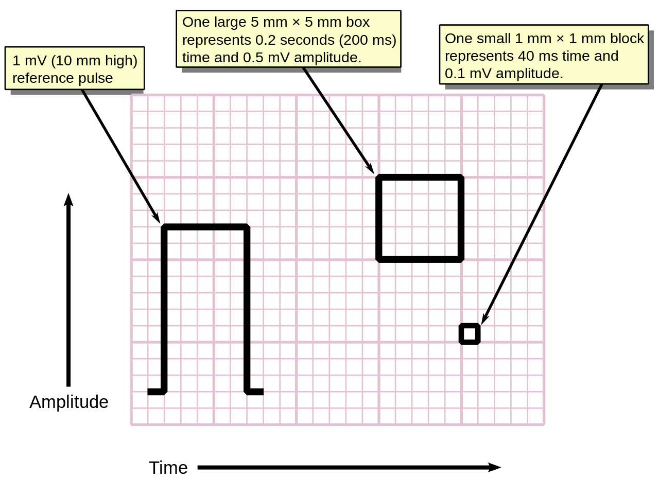 Diagram of EKG paper