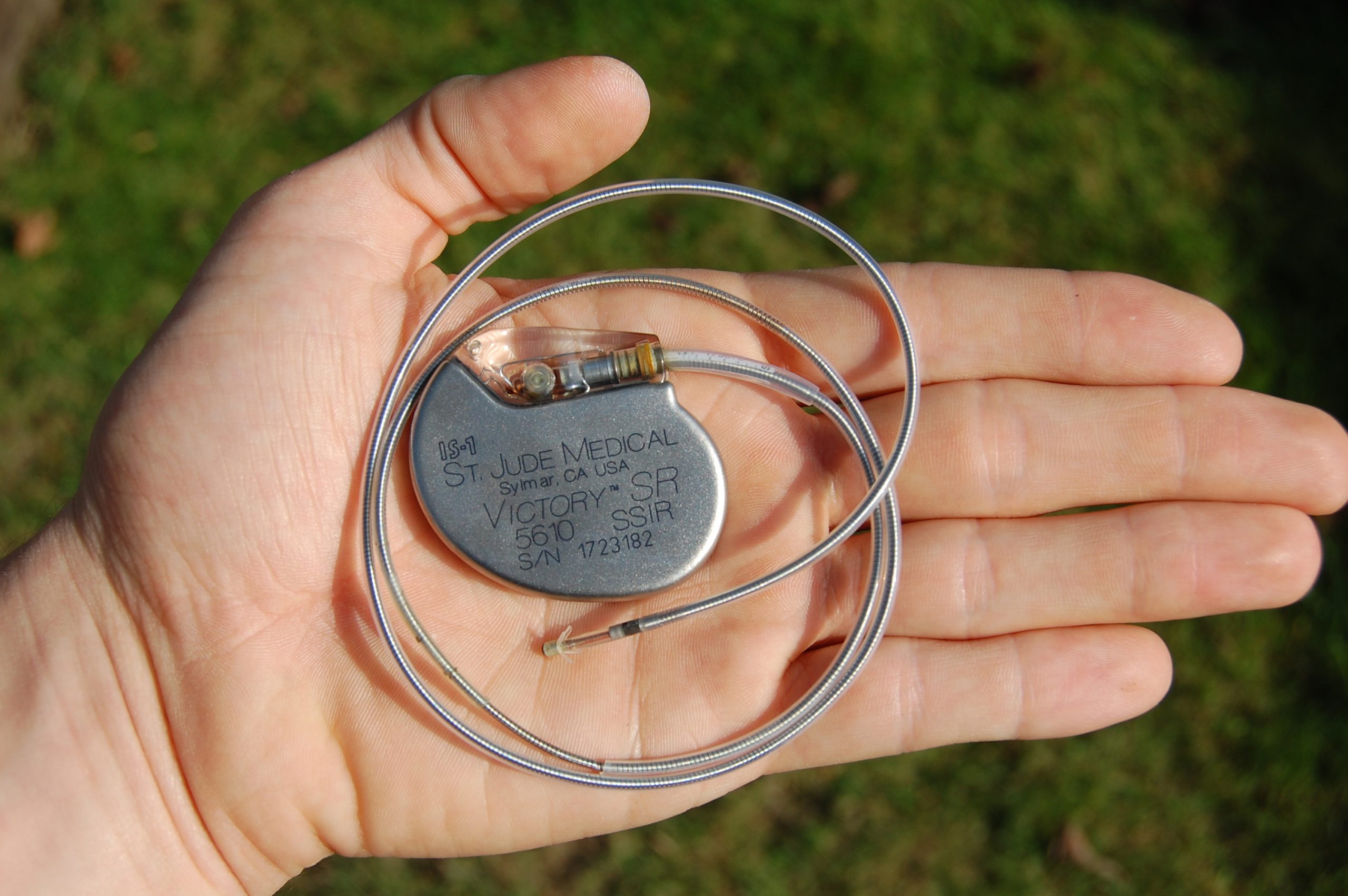 A person holding a St. Jude Medical pacemaker with attached leads in the palm of their hand.