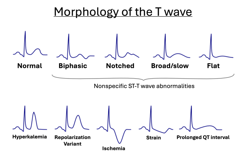 How to Interpret Rhythm Strips – EKG Essentials: A Student Handbook