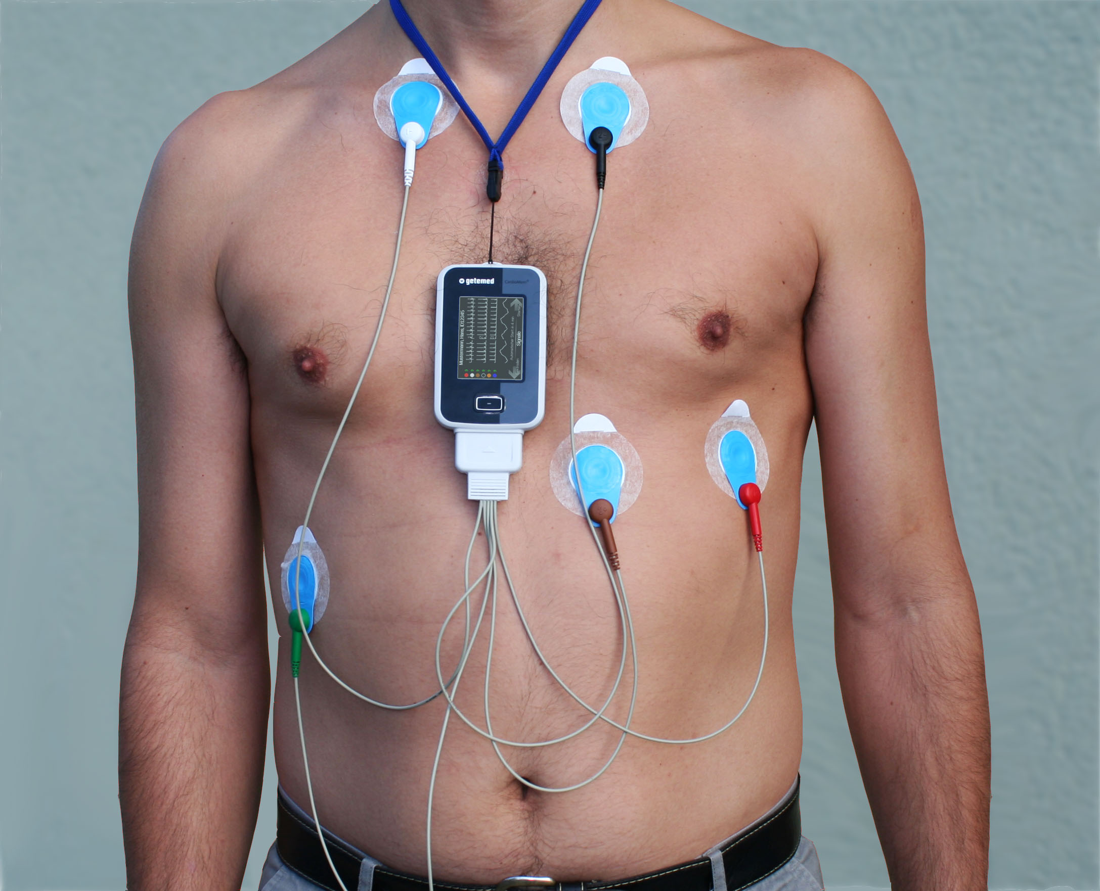 A person wearing an EKG telemetry device on their chest, with multiple electrodes attached to their skin using adhesive pads. The electrodes are connected to a small portable monitor hanging around the neck, which displays the heart's electrical activity.